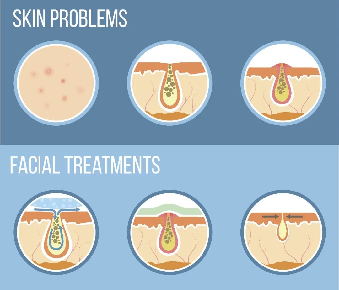 收缩毛孔比较靠谱的方法,收缩毛孔美颜妙招
