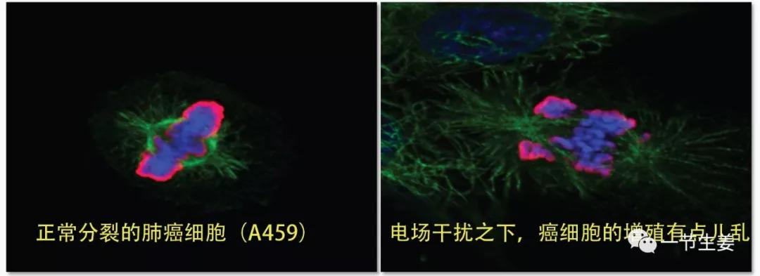 肺癌最新临床试验,3期临床试验结果是否能过关