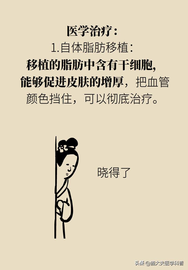 医生黑眼圈,手术消除黑眼圈靠谱吗