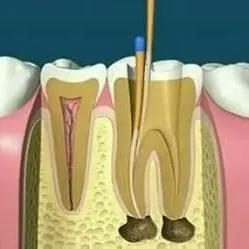 白天不牙疼为啥一到晚上就疼,老是晚上牙疼厉害睡不了觉
