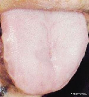 什么样的舌苔是清热祛湿好了,舌苔黄腻的人应注意什么