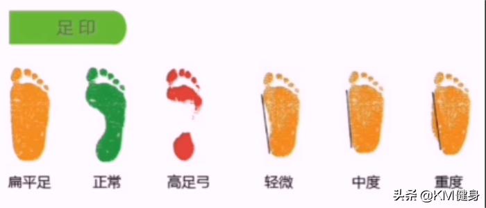 扁平足深蹲脚外侧发力,改善扁平足o型腿的训练方法