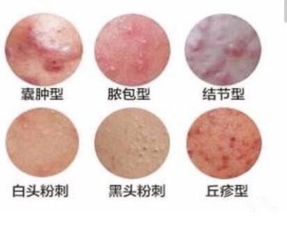 什么是损容性皮肤,损容性皮肤病名词解释