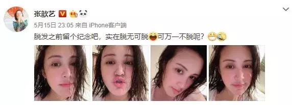 拯救发际线告别大额头,拯救发际线不走冤枉路