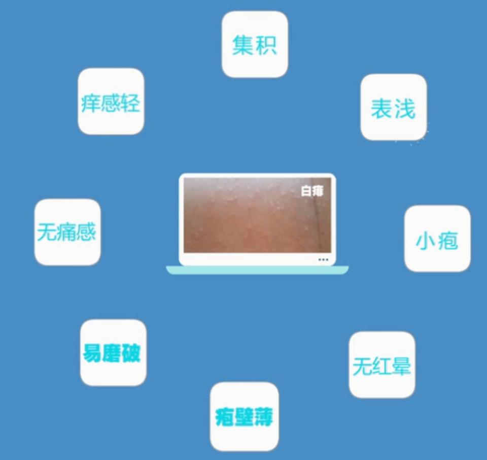 宝宝热出痱子婆婆说烂胎盘,高温天气宝宝热痱子怎么治好得快