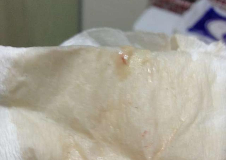 孕晚期足月出生注意事项,孕妇差不多需要提前进医院待产吗