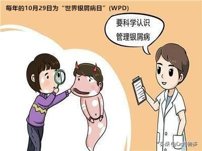 牛皮癣导致关节肿痛如何止痛,得了牛皮癣能治愈吗