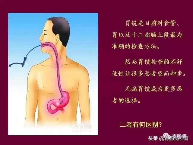 无痛胃镜需要注意什么事项吗,做无痛胃镜有什么禁忌吗