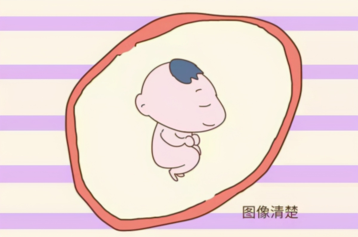 四维彩超胎儿臀位不配合怎么办,照四维彩超宝宝一直不配合怎么办