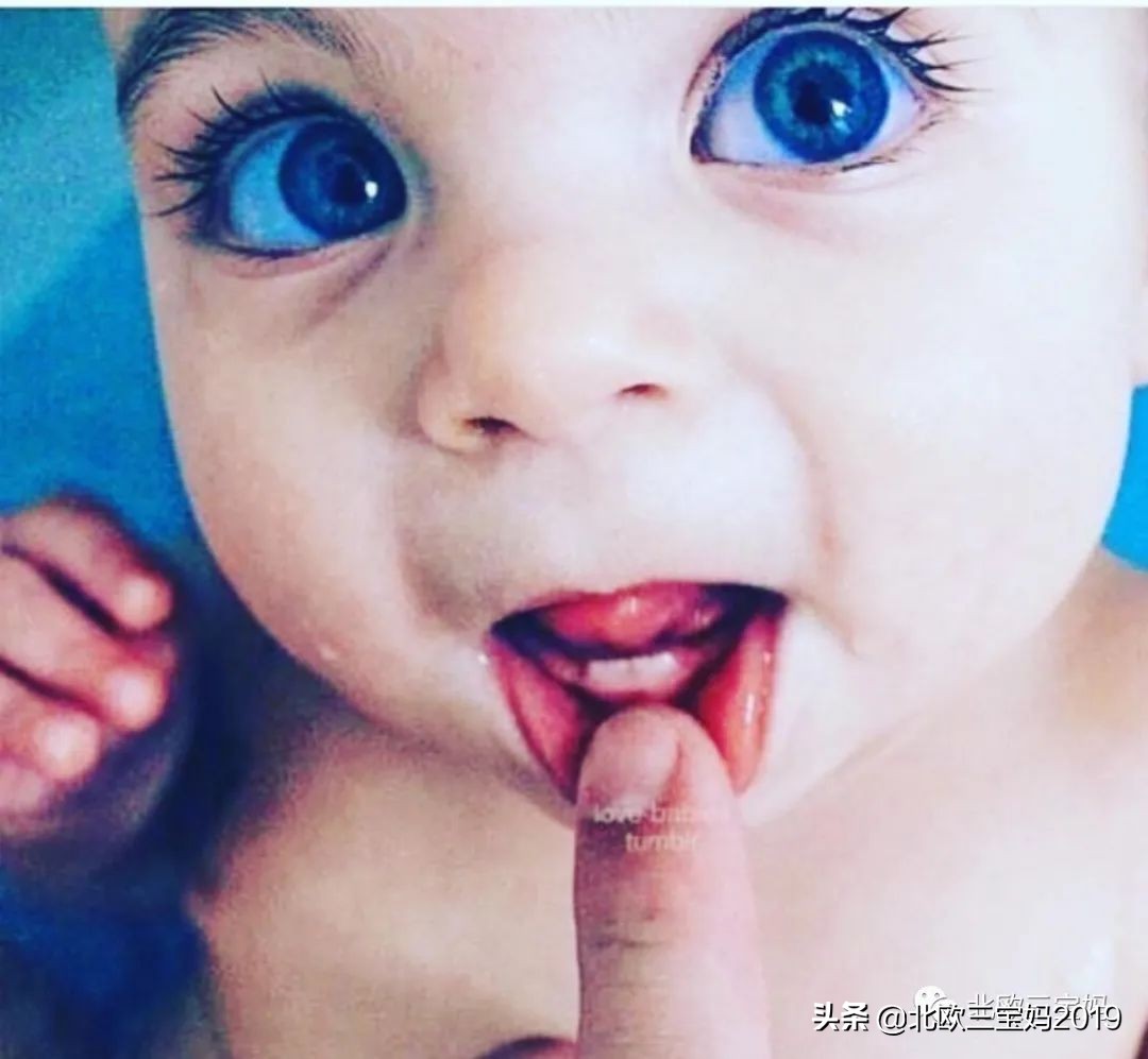 5岁小孩打全麻治蛀牙有影响吗,3岁孩子全麻风险大吗