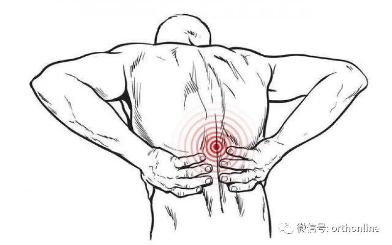 腰椎间盘突出症疼痛部位的定位,怎么判断是腰椎间盘突出疼痛