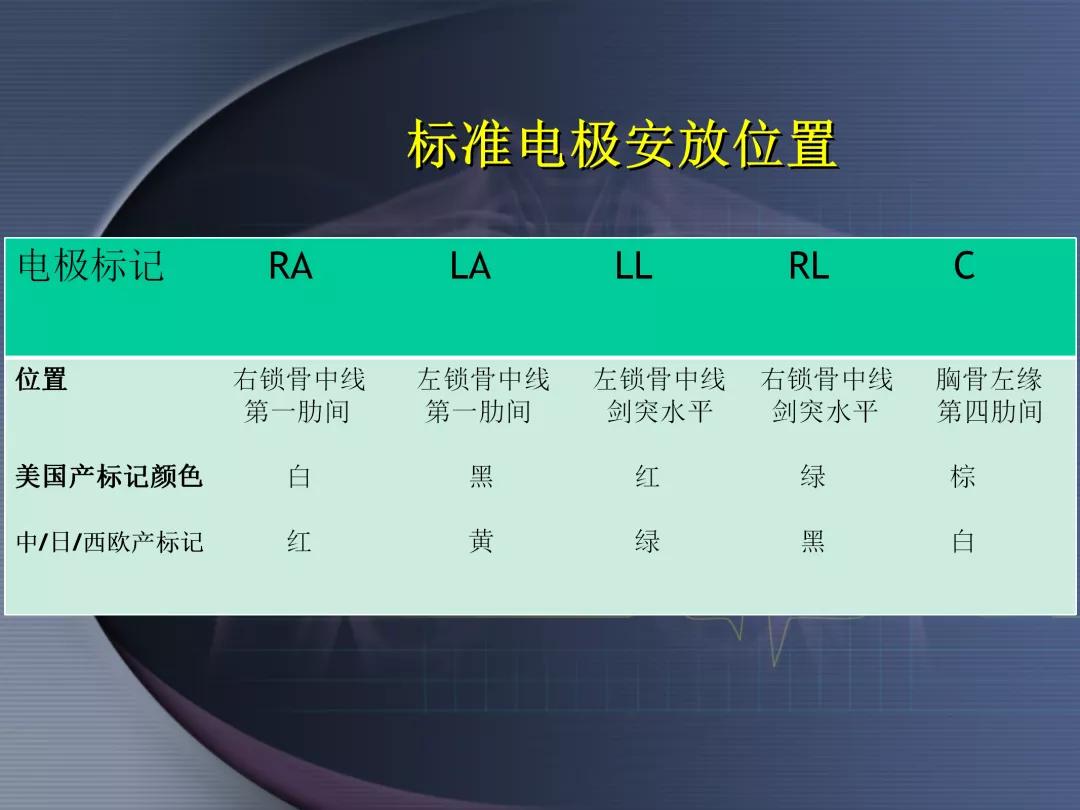 麻醉手术常见心律失常处理,麻醉引起心脏骤停原因
