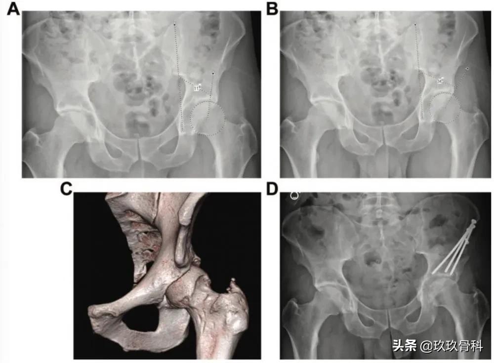 髋膝关节文献精译荟萃