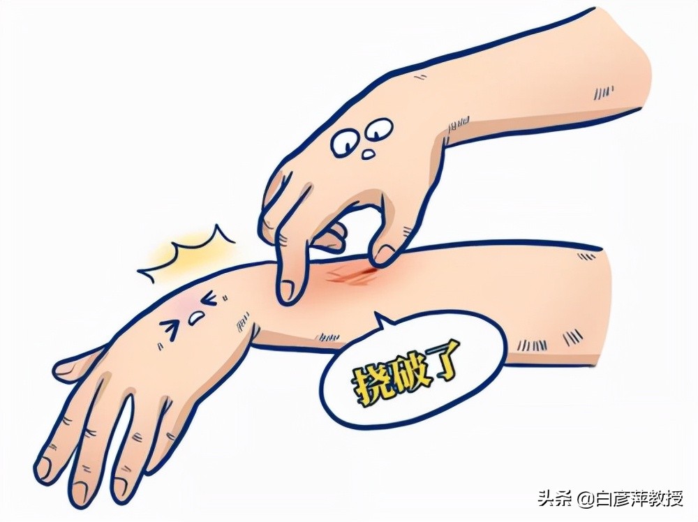 疥疮？一种奇痒又会传染的皮肤疾病