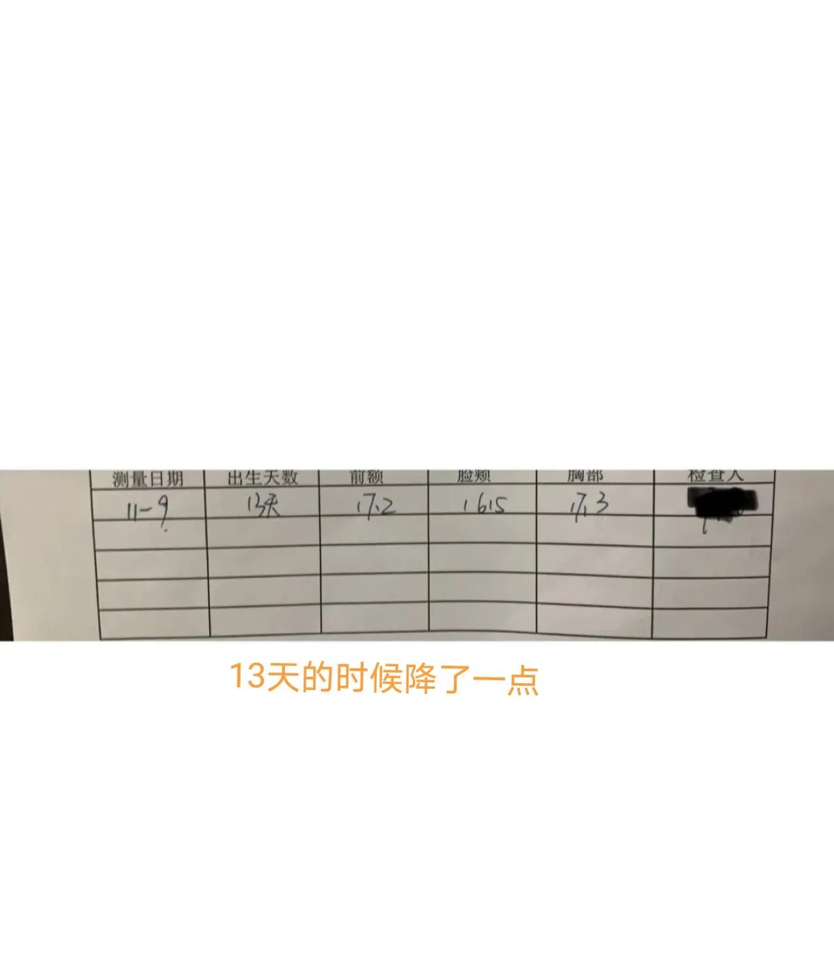 宝宝黄疸好转有哪些征兆,亲身经历宝宝黄疸过程