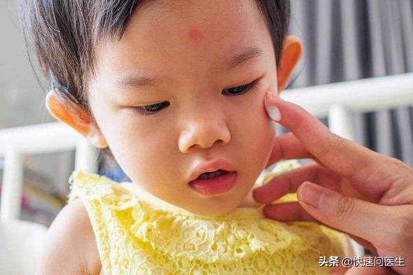 宝宝长湿疹抹炉甘石洗剂还更严重,宝宝长湿疹用药擦对身体有影响吗