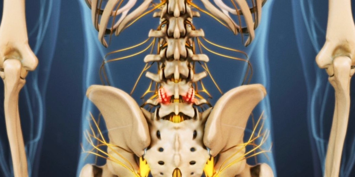健身如何改善腰部疼痛感,锻炼腰肌出现疼痛