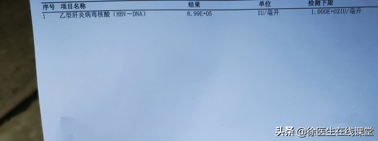 体检两对半阳性可以治疗吗,体检乙肝两对半25阳性怎么回事
