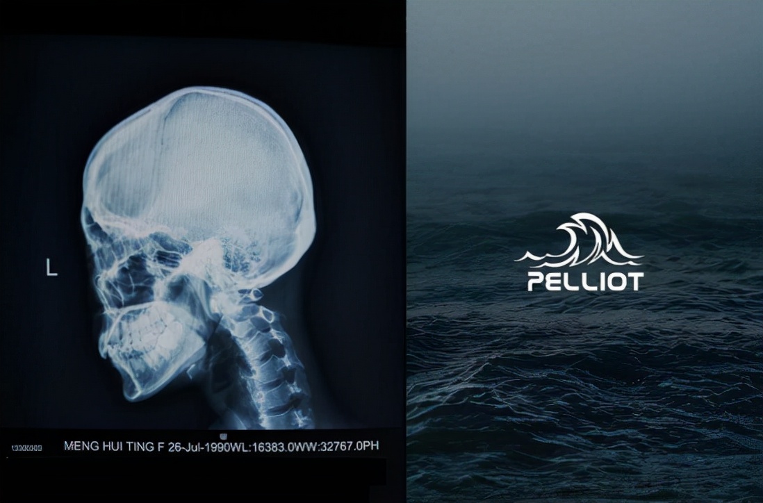 佟丽娅同款伯希和冲锋衣质量好吗,伯希和佟丽娅同款紫色冲锋衣测评