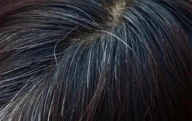 教你一招白发变黑发抖音视频,最简单又最有效的白发变黑发方法