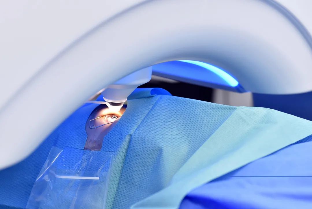 人民日报5个动作预防近视,做近视手术什么是全飞秒