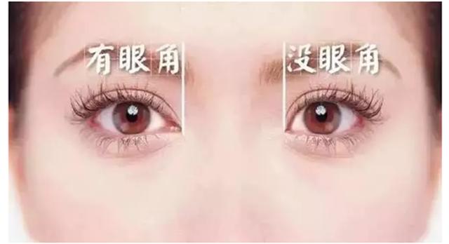 开了眼角会变回原来吗,开过的外眼角会长起来吗