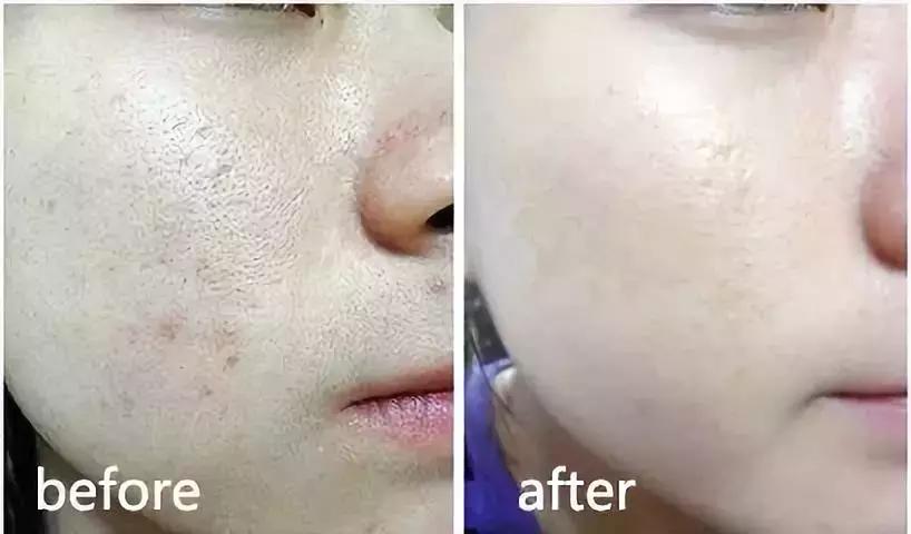 大创美白精华和雪肌精哪个好,大创美白精华