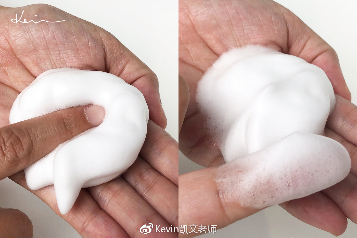 鏁忔劅鑲岀鐥樹竴濂楁姢鑲ゅ搧鎺ㄨ崘 (鏁忔劅鑲岀鐥樻姢鑲ゅ搧)