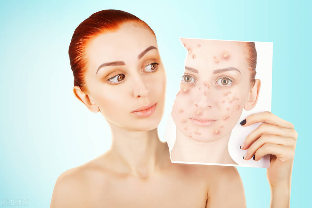 有痘痘如何正确敷面膜,敷面膜对痘痘会有什么影响吗