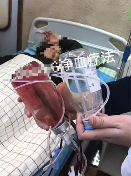 净血排毒疗法是否是骗人的,网红防癌护肤品