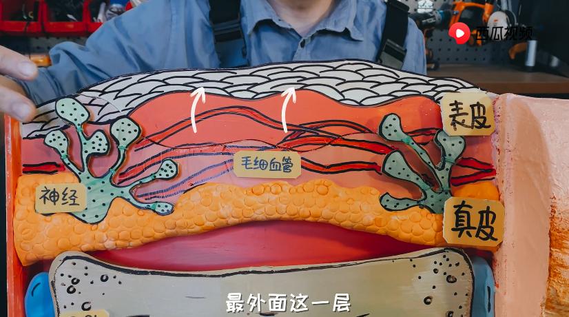 烫伤不小心把水泡戳破了怎么办,皮肤被烫伤起的水泡可以戳破吗