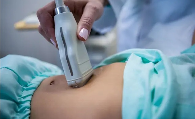 子宫不全切,子宫可以不切吗