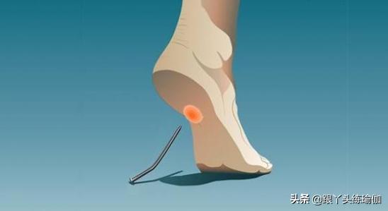 一天走3万步怎么防止足底筋膜炎,每天必须走路怎么治足底筋膜炎