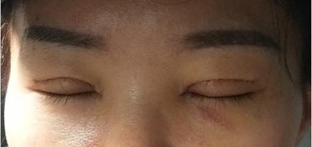 男的割双眼皮好看吗,割双眼皮好看吗动画