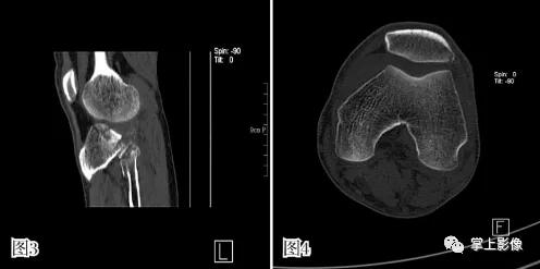 一种很少人知道的疾病,有哪些关节疾病