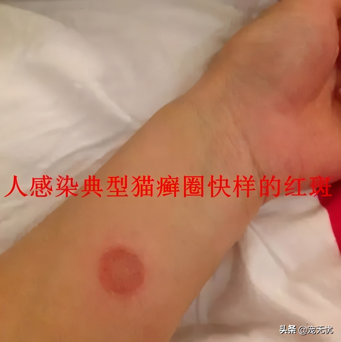 猫咪感染猫癣？不要急，这篇文章全部给你解决