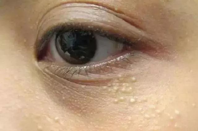 去细纹的电动眼霜,能熨平皱纹的眼霜