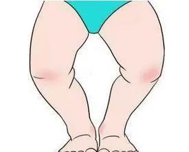 一岁4个月宝宝o型腿最佳矫正时间,1岁半的孩子o型腿正常吗