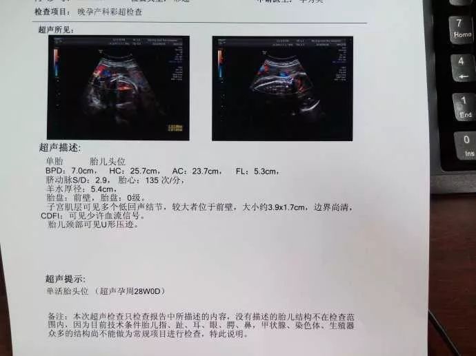 产前大出血造成流产?产检的注意事项,准妈妈们要注意收藏