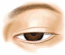 不建议做双眼皮的三种情况,为什么不建议做双眼皮