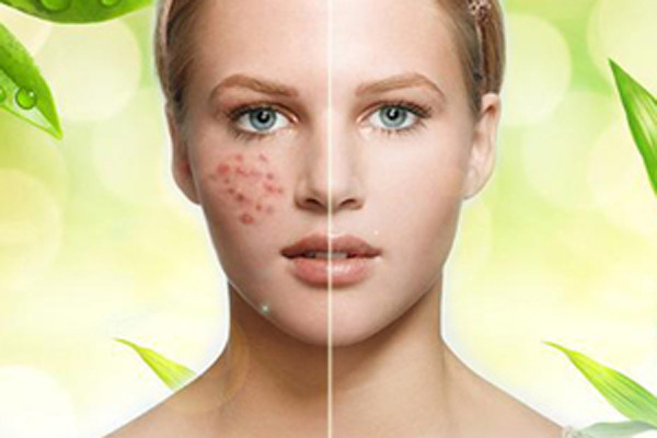 50岁女人皮肤干燥缺水怎么补,身体皮肤干燥缺水补水最快的方法