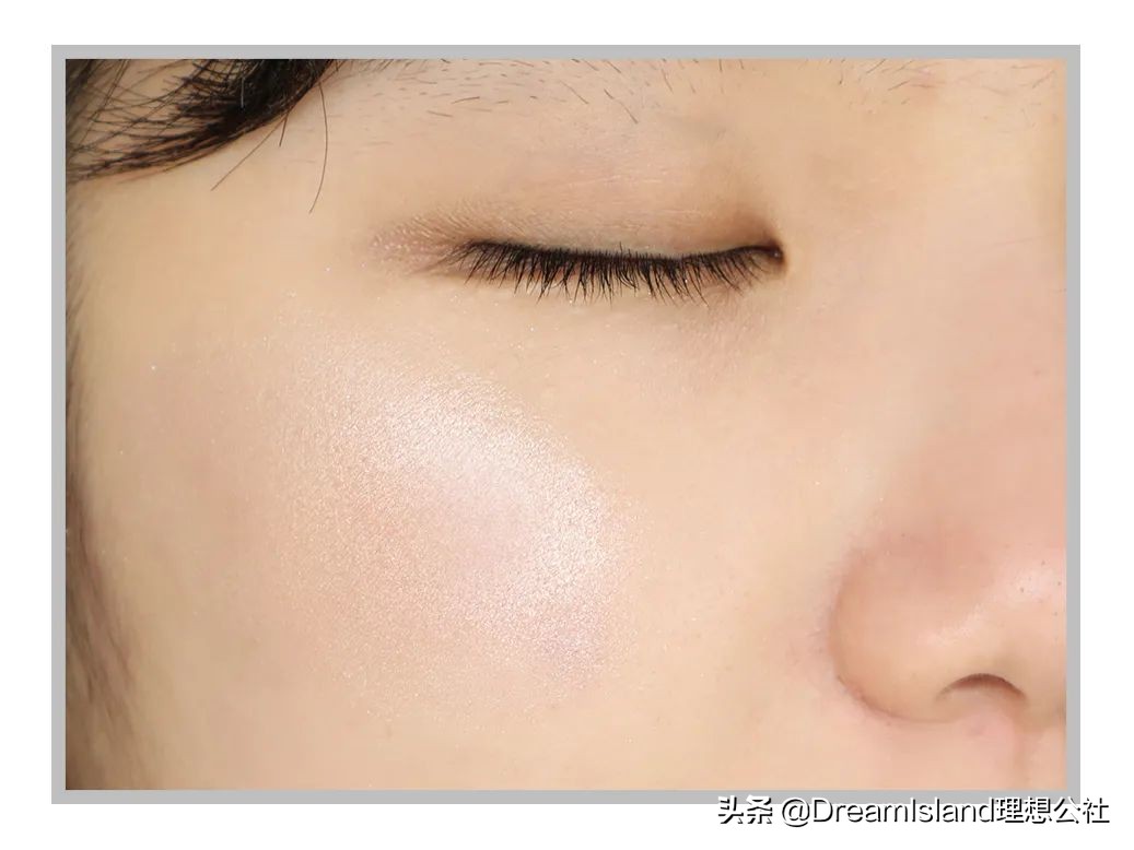 玻尿酸高光排名,打玻尿酸高光推荐