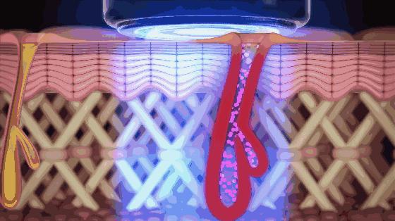 橘子皮怎么收缩毛孔,毛孔粗大橘子皮肤质还有救吗