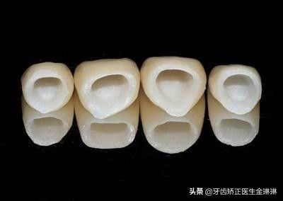 山东烤瓷牙什么牌子好,乌市烤瓷牙全瓷的多少钱一颗