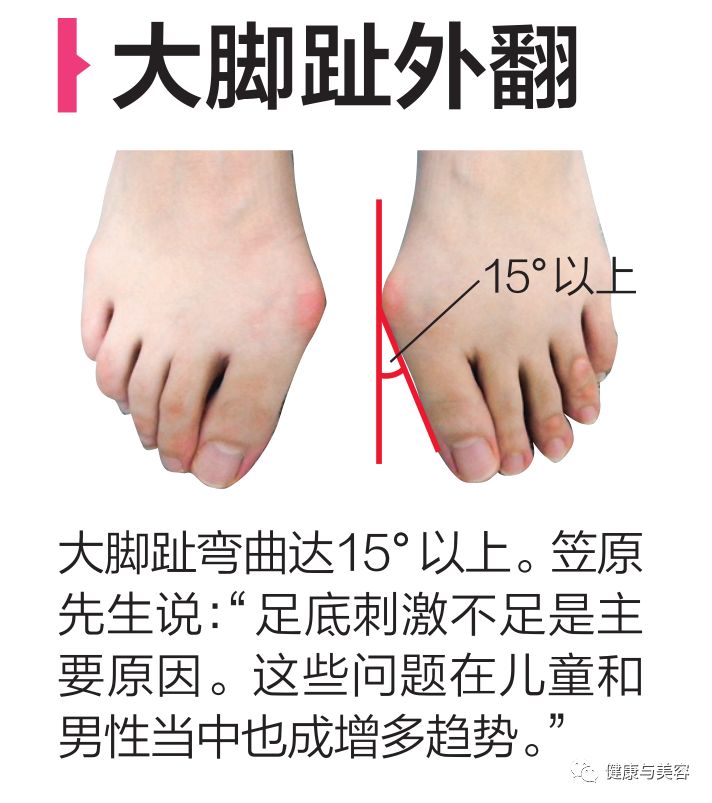 黄晓明谈身高被攻击,黄晓明的脚是如何康复的