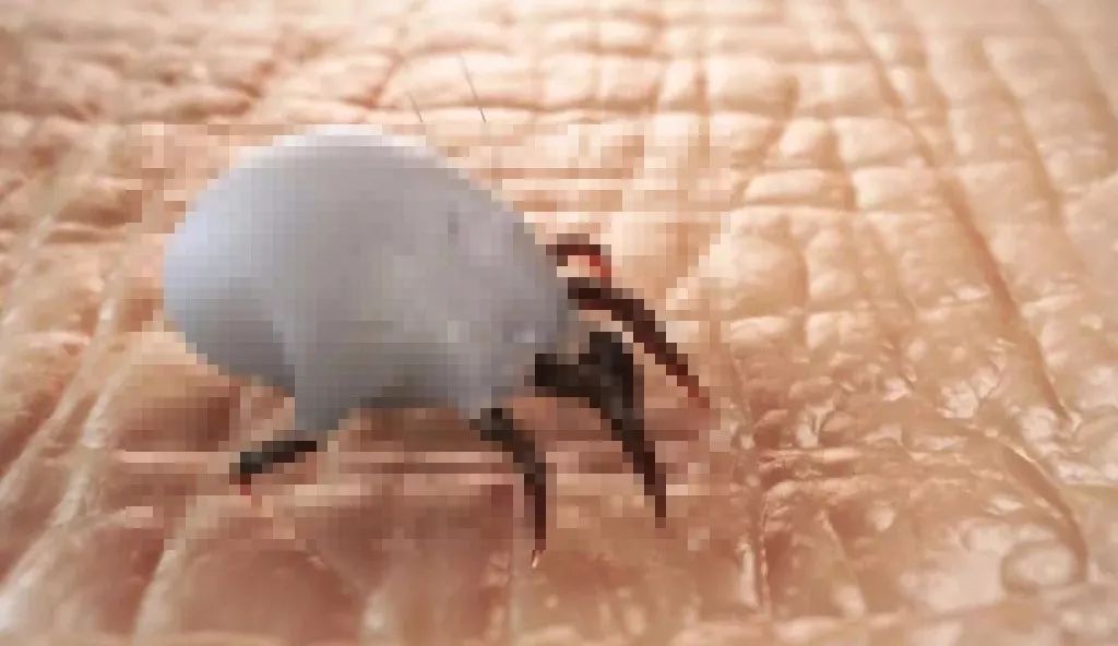 脸上长白色米粒痘痘怎么快速消除,脸上痘痘里面白色米粒是什么东西