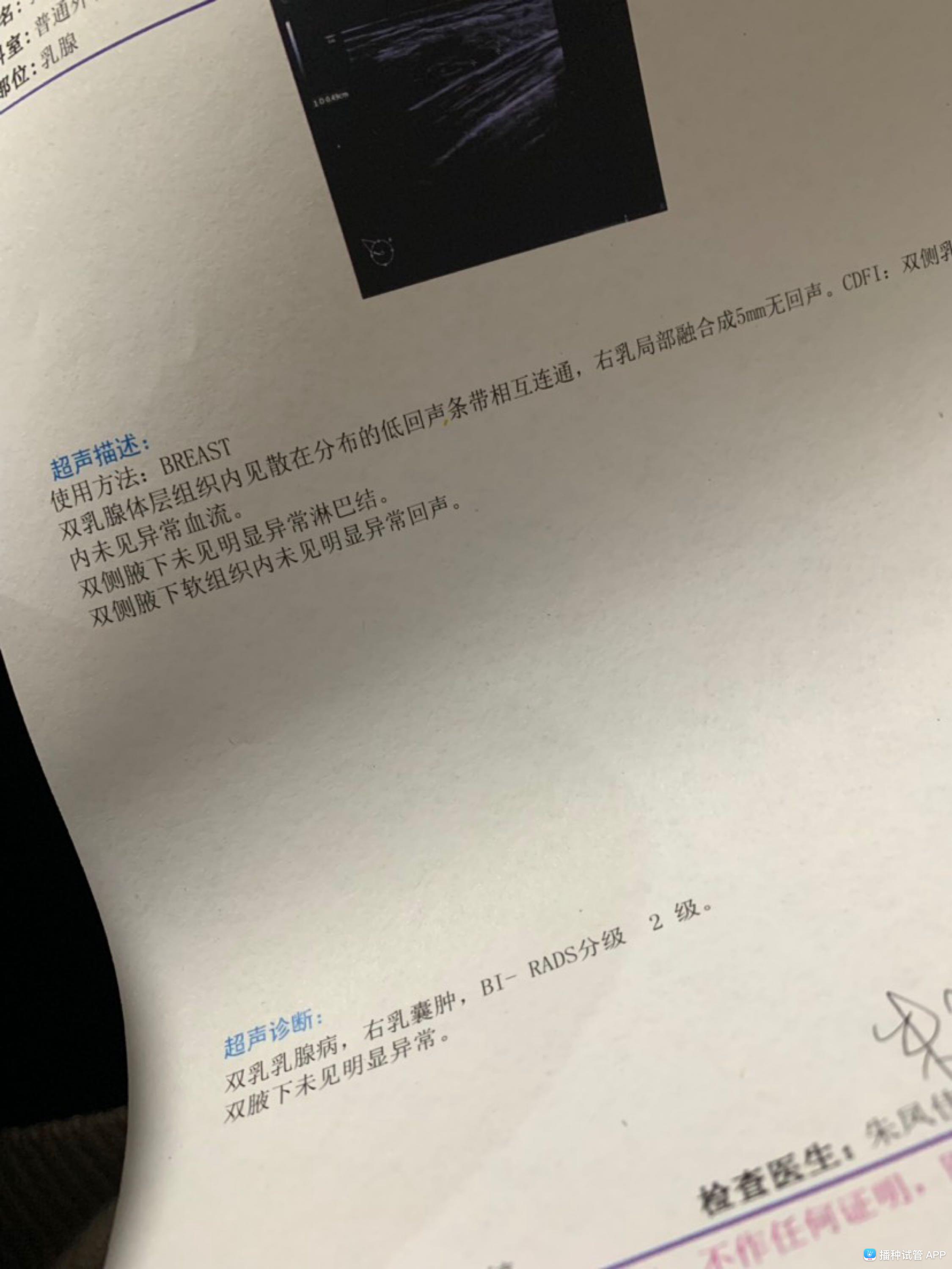 结节息肉囊肿增生哪个更容易癌变,结节囊肿增生息肉有什么区别