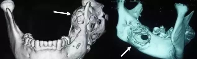 多大年龄出现牙痛,小小年纪就有牙痛怎么办