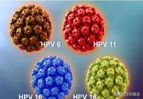 人乳头瘤病毒hpv和甲状腺有关系吗,人乳头瘤病毒hpv45阳性是宫颈癌吗