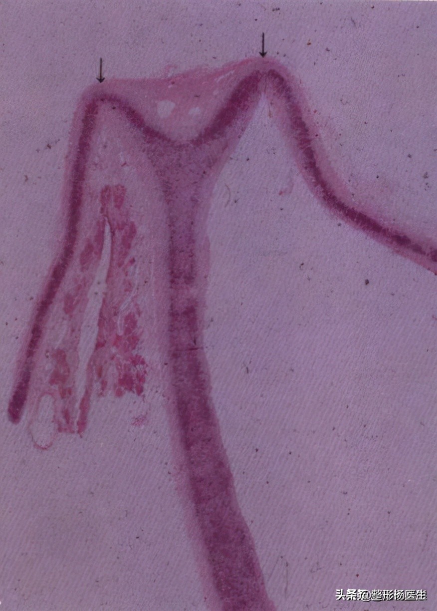 鼻梁可以捏真的假的,捏鼻梁神器变高真的吗